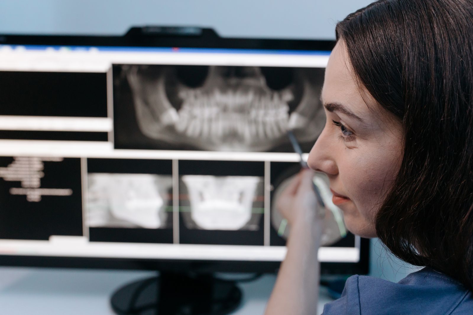 A dentist studying dental X-rays on a monitor